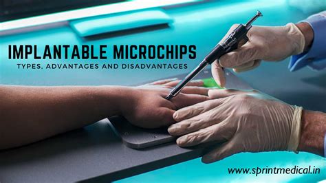 radio frequency identification chip in humans|Microchip implant (human) .